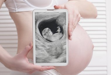 Hamile kadın tutarak ve dijital tablet cenin ultrason fotoğraf ile beyaz ahşap arka plan üzerinde gösterilen iç çamaşırı. Yakın çekim