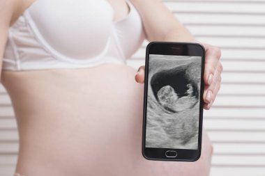 Hamile kadın tutarak ve smartphone cenin ultrason fotoğraf ile beyaz ahşap ekran arka plan üzerinde gösterilen iç çamaşırı. Yakın çekim