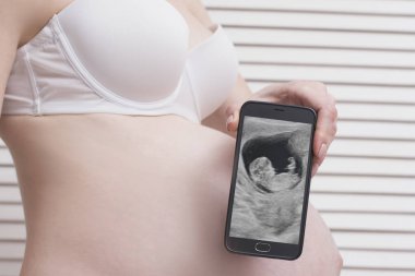 Beyaz ahşap ekran arka planda fetal ultrason fotoğraf ile cep telefonu tutan ve gösteren iç çamaşırı hamile kadın. Close