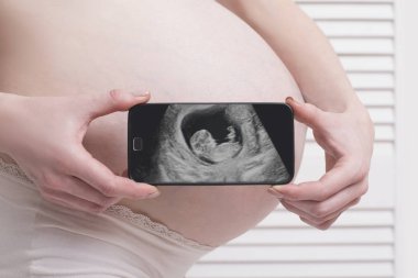 Beyaz ahşap ekran arka planda fetal ultrason fotoğraf ile cep telefonu tutan ve gösteren iç çamaşırı hamile kadın. Close