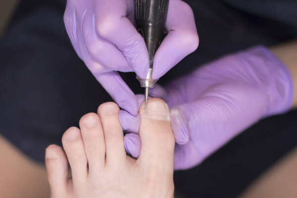 Processing toenails, pedicure. Gloved hands with a pedicure cutter. Close-up