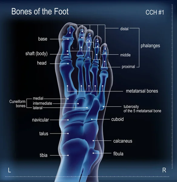Röntgenbild der Knochen des Fußes — Stockvektor