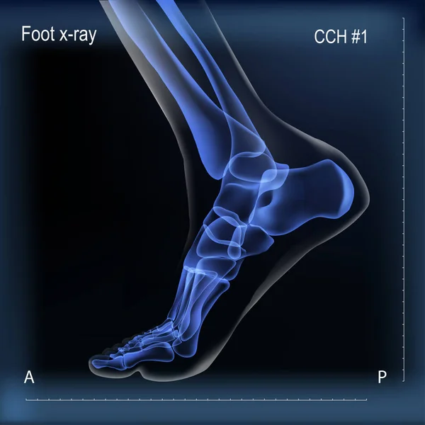 Vista mediale x raggi di ossa del piede . — Vettoriale Stock