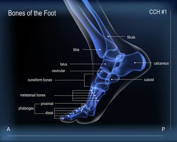 X ray tulang kaki tersebut. Tampilan media - Stok Vektor