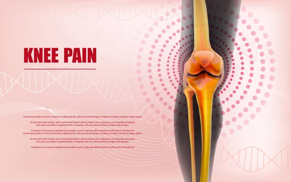 Alivio del dolor de rodilla Huesos de la rodilla — Vector de stock