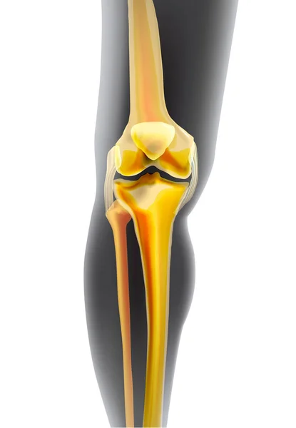Luz realista de los huesos amarillos de la rodilla — Vector de stock