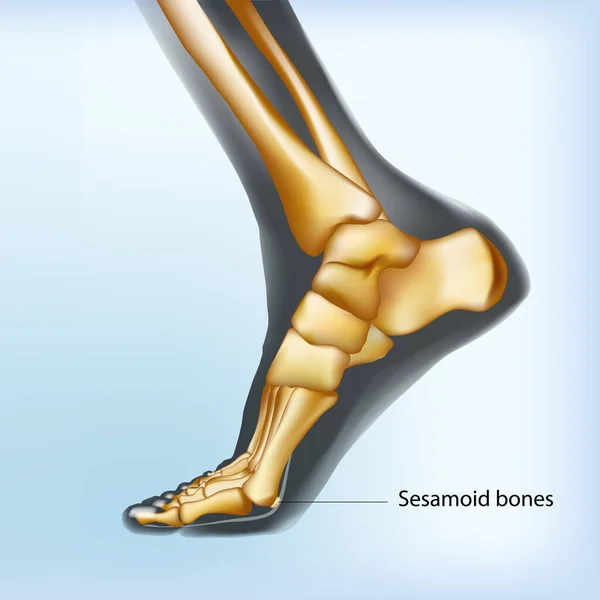 Visualização naturalista de ossos sesamoides do pé . — Vetor de Stock