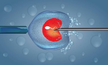 Vitro fertilizasyon enjeksiyon. Suni tohumlama. Bilimsel Tıbbi resimli vektör.
