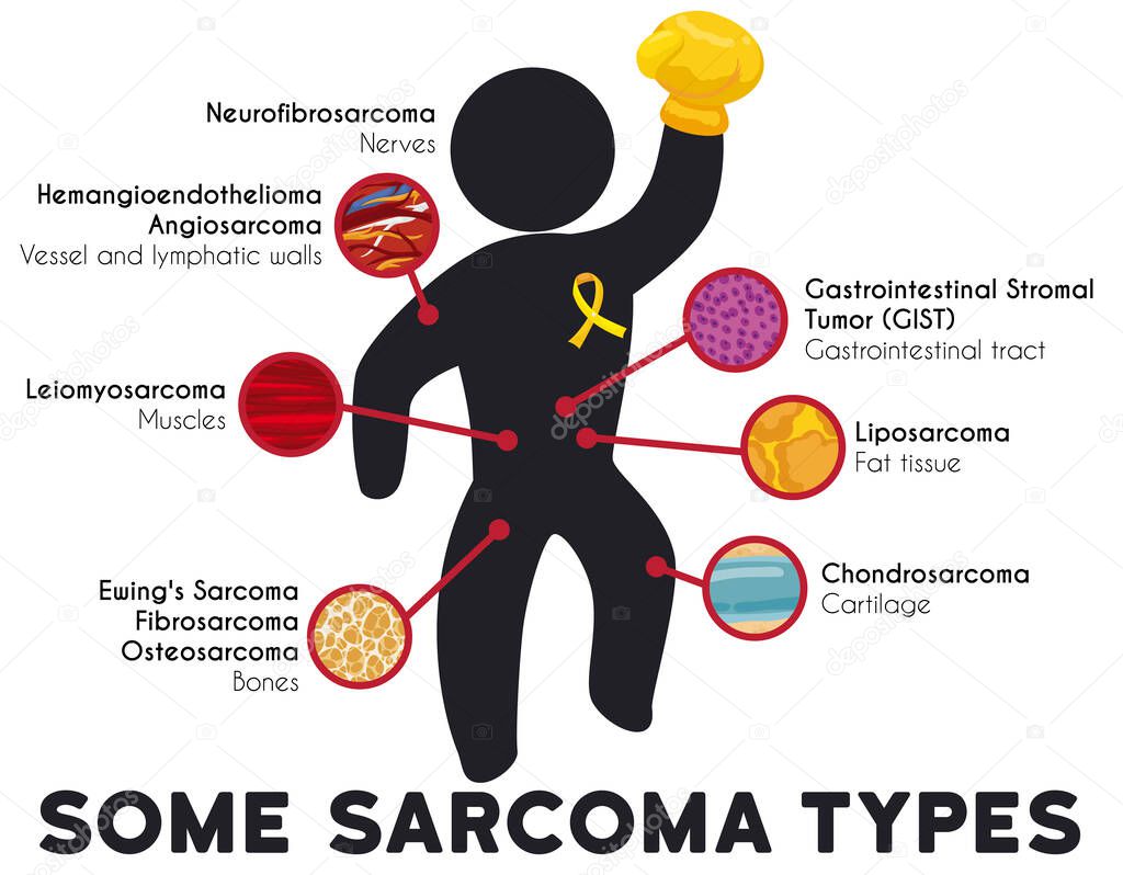 Infographic with pictogram wearing a yellow box glove and ribbon with detailed type of sarcoma, and the principal afflicted tissues by this disease.