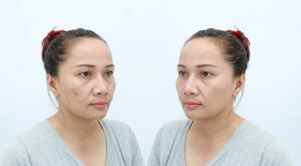 Femme Asiatique Âge Moyen Avant Après Retouche Concept Maquillage Chirurgie — Photo