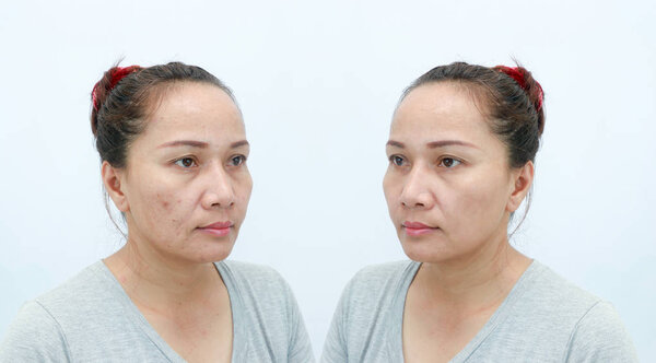 Asian middle-aged woman before and after retouch, concept of makeup or plastic surgery.