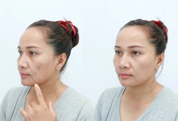 Femme Asiatique Âge Moyen Avant Après Retouche Concept Maquillage Chirurgie — Photo