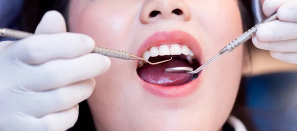 Concepto Salud Dental Dental Clínica Dental Dentista Check Dientes Para — Foto de Stock