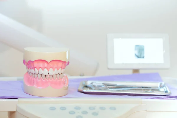 Implante Dentário Dentes Falsos Conceito Odontologia Saúde Clínica Dentária — Fotografia de Stock