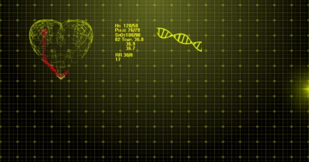 O monitor cardíaco do ECG está fixo. ECG com pulsação cardíaca. Alta qualidade, animação 4K completa. Símbolo do coração cheio de líquido. O conceito de recuperação após tratamento médico — Vídeo de Stock