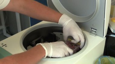 Ceske Budejovice, Çek Cumhuriyeti, 2 Eylül 2018: Santrifüj bilim adamı bakteriyel örnekleri ile örnek benchtop laboratuar uygulama örnek tüp bilimi sıvı, tam aralığını verir.