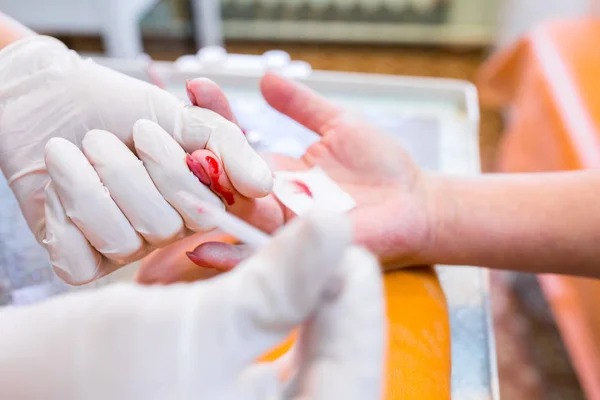 Sairaanhoitajan kädet valitse annos verta sormen naisen rapi — kuvapankkivalokuva