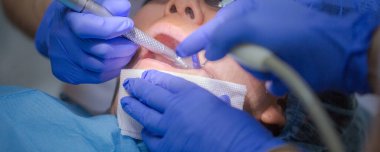 Diş muayenesi sırasında Asyalı bir kadın hasta diş hekimi randevusunda. İnsan ağzı yakından açılır. Işığı yüzüne tut. Diş hekimi ilk muayeneyi, diş temizleme ve ağız boşluğunu yapar..