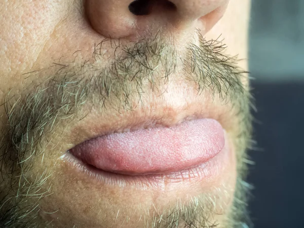 Fragment of a male face, nose, mustache, lips and slightly protruding tongue.