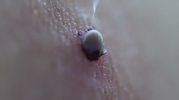 Teek vastgemaakt aan de menselijke huid voeden met bloed — Stockvideo