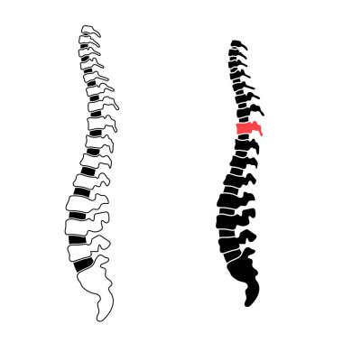 Vektör insan omurga çizim