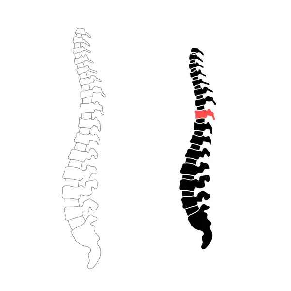 Colonna vertebrale umana vettoriale con dolore — Vettoriale Stock