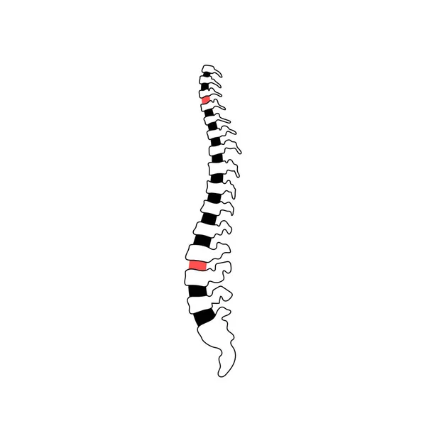 Vectorillustratie menselijke wervelkolom — Stockvector