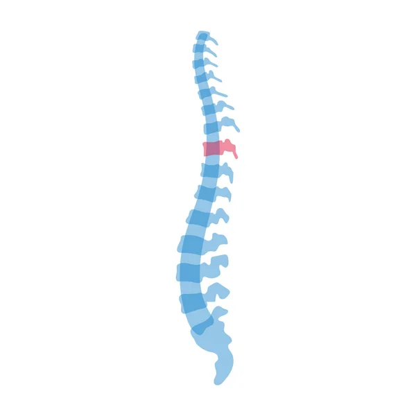 Colonna vertebrale umana vettoriale con dolore — Vettoriale Stock