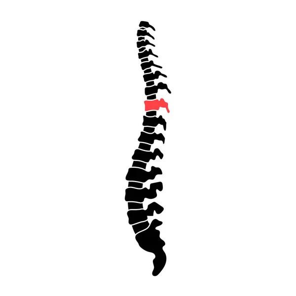 Illustrazione della colonna vertebrale umana vettoriale — Vettoriale Stock