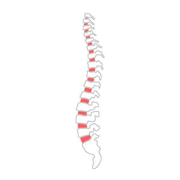 人間の背骨のベクトル図 — ストックベクタ