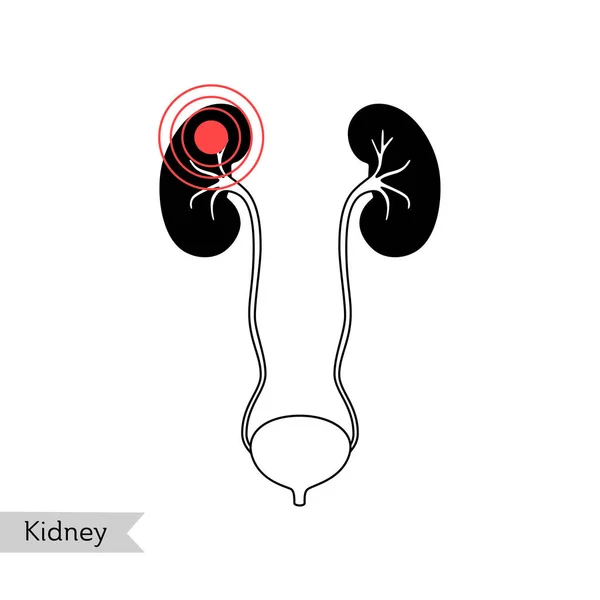 Ilustración aislada vectorial del riñón — Vector de stock