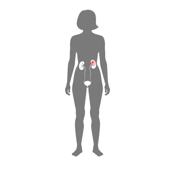 Ilustração vetorial do rim —  Vetores de Stock