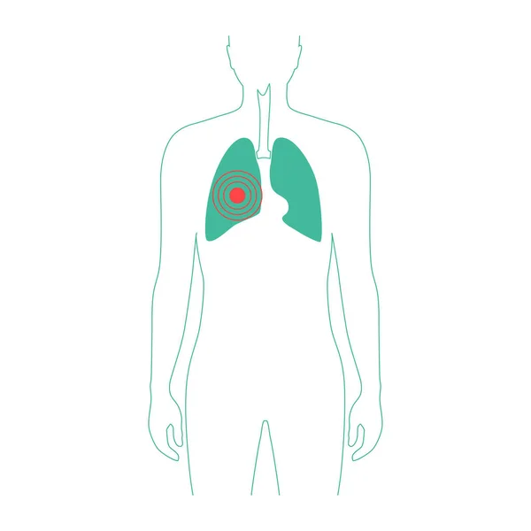Ilustração vetorial isolada do pulmão — Vetor de Stock