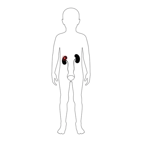 Ilustración aislada vectorial del riñón — Archivo Imágenes Vectoriales