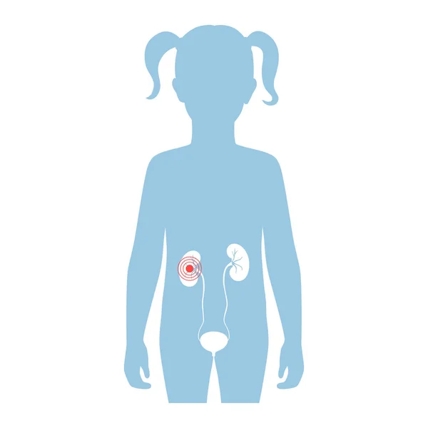 Ilustración aislada vectorial del riñón — Archivo Imágenes Vectoriales