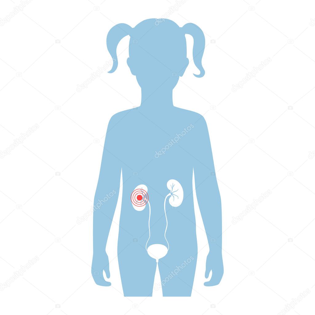 Vector isolated illustration of kidney anatomy in girl body. Human excretory system icon. Healthcare medical center, surgery, hospital, clinic logo. Internal donor organ symbol poster design. Donation