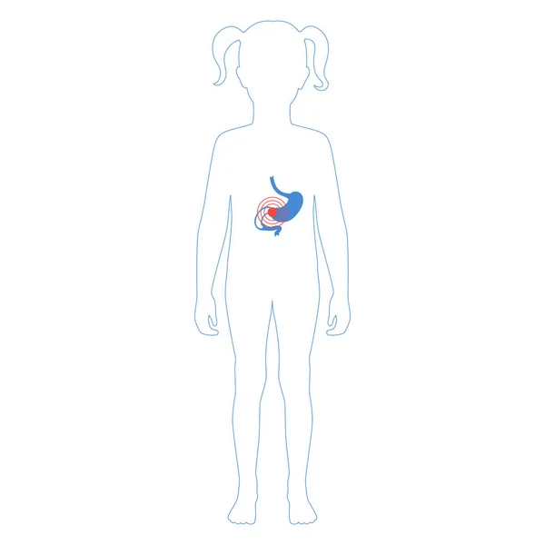 Ilustración aislada vectorial del estómago — Archivo Imágenes Vectoriales