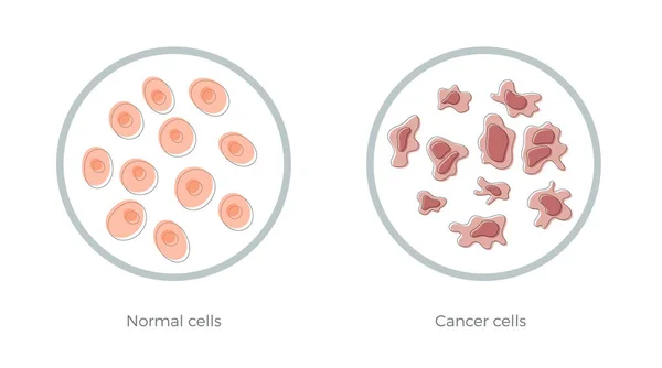 Estructura celular: normal y cáncer — Vector de stock