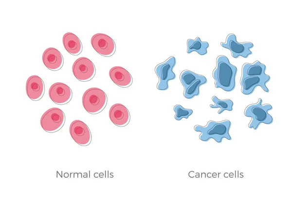 Estructura celular: normal y cáncer — Archivo Imágenes Vectoriales