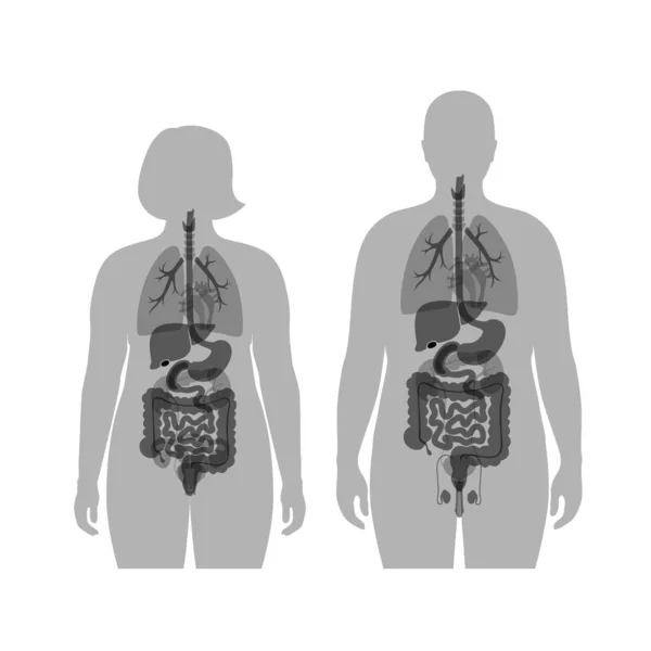 Órganos internos de hombres y mujeres obesos — Archivo Imágenes Vectoriales