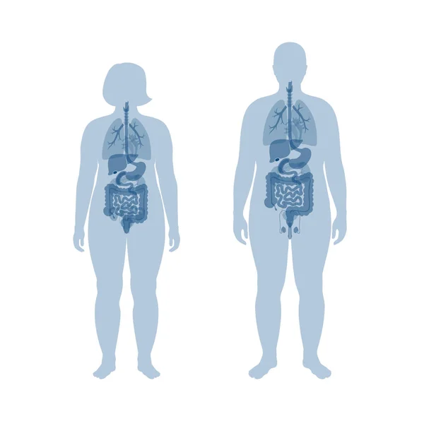 肥満男性と女性の内臓 — ストックベクタ