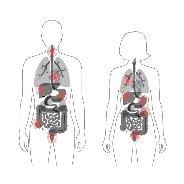 Dolor en el cuerpo humano — Archivo Imágenes Vectoriales