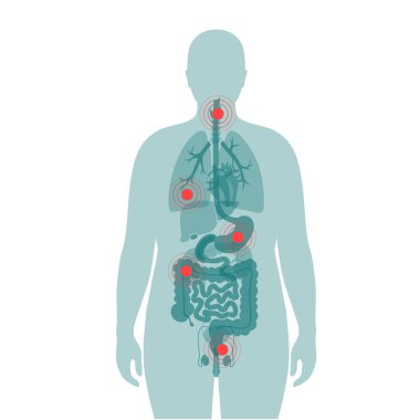 İnsan vücudunda acı