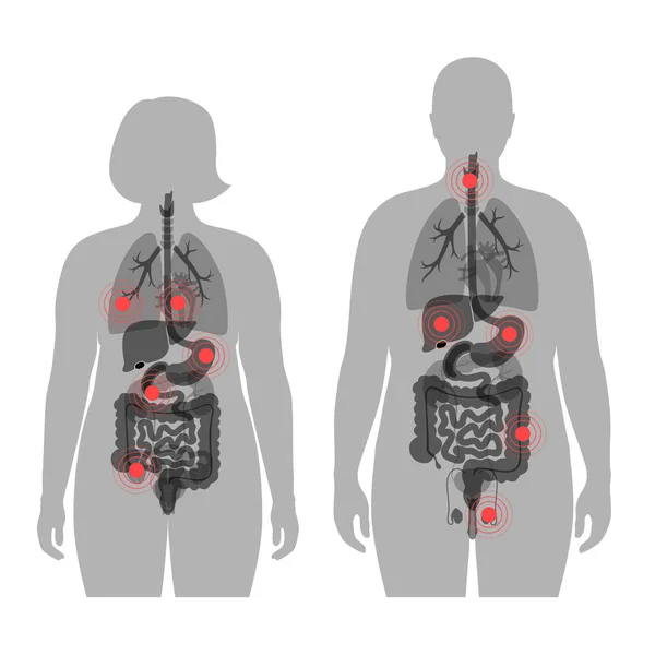 Dolor en el cuerpo humano — Vector de stock