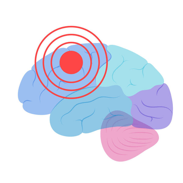 Pain Brain Illustration