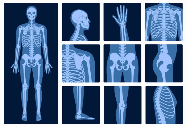 Squelette radiographie — Image vectorielle