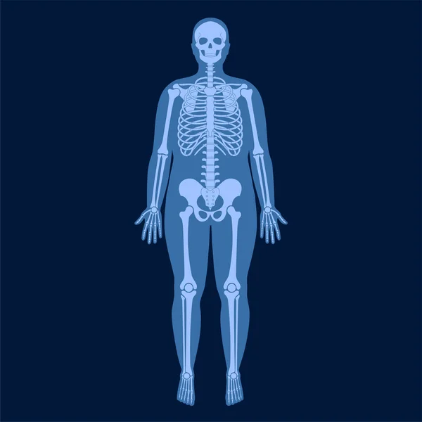 Skeleton x ray — Stockový vektor