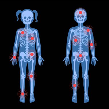 İskelet X ışını