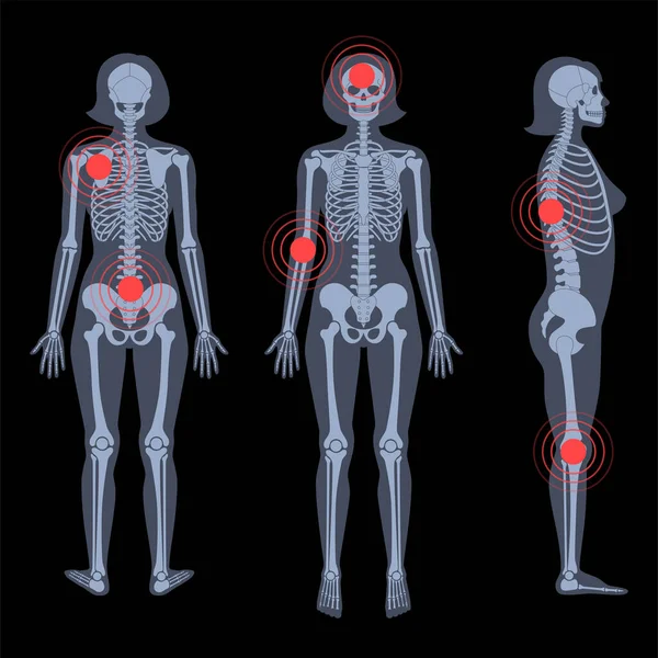 Röntgenfoto van skeletten — Stockvector