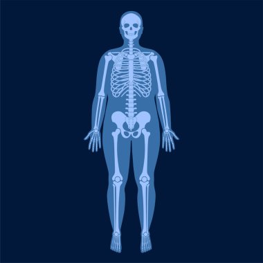 İskelet X ışını